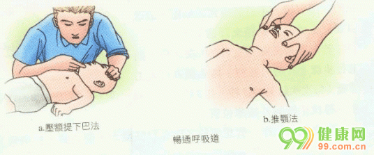 心肺复苏 CPR 婴儿心肺复苏