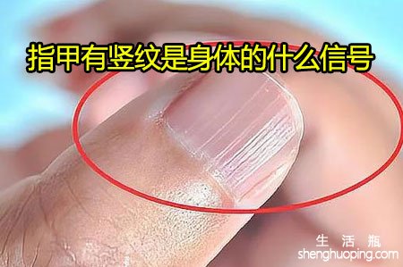 <b>指甲有竖纹是身体的什么信号</b>