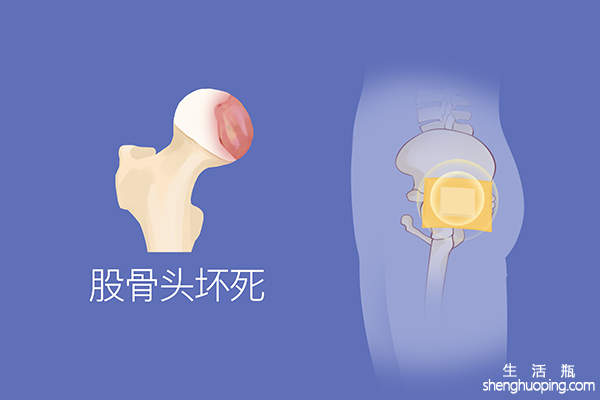 什么生活习惯会导致胯骨痛？